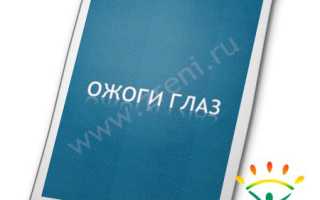 Код мкб ожог глаза