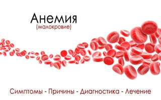 Синдром анемии и чем лечить