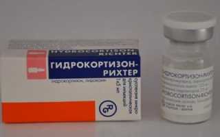 Как лечить туннельный синдром народными средствами