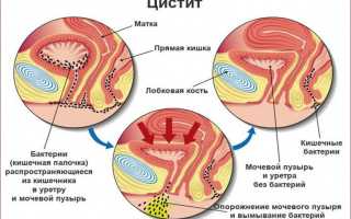Синдром раздраженного мочевого пузыря лечение препараты