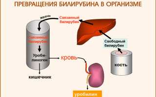 Синдром жильбера какие лекарства нельзя