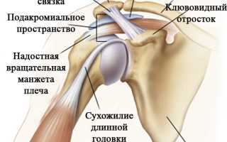 Лечение болевого синдрома плечевого сустава