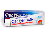 Межреберная невралгия