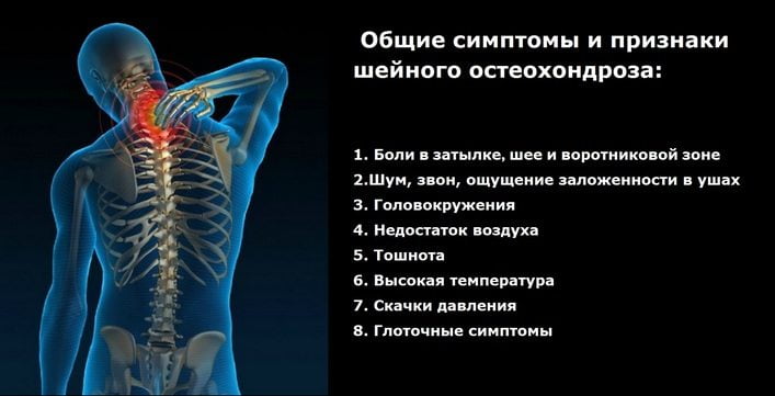 Лфк при поясничном остеохондрозе с корешковым синдромом