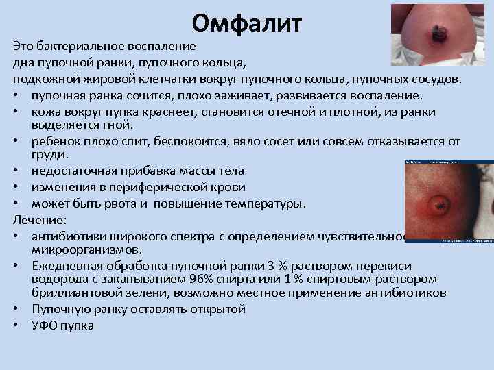 Мокнутие пупка код по мкб 10