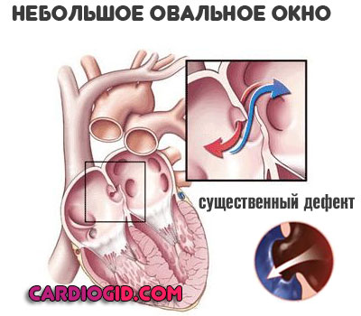 небольшое-овальное-окно