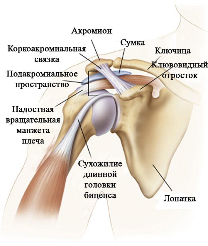 Лечение болевого синдрома плечевого сустава