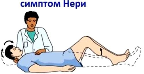 Лфк при поясничном остеохондрозе с корешковым синдромом